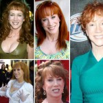 Plastic Surgery Without Moderation