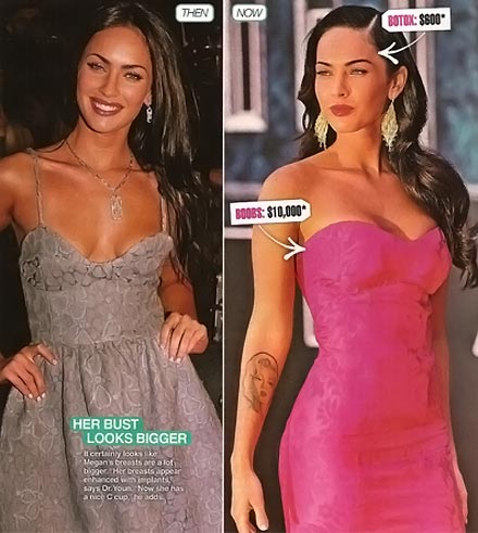 megan fox before and after plastic surgery