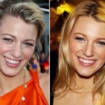 Blake Lively plastic surgery nose