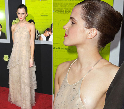 Emma Watson Red Carpet Wardrobe Malfunction