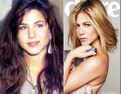 Jennifer Aniston Before And After Plastic Surgery