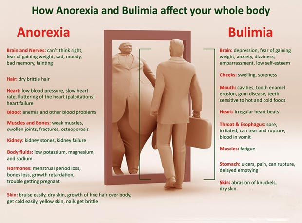 how Anorexia and bulimia affect the person inforaphic