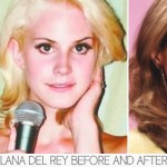 Lana del Rey before and after plastic surgery