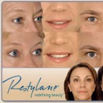 Restylane Injections Images